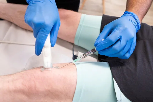 Knee osteoarthritis injection therapy